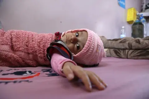 Silent humanitarian calamity in Yemen: Who to blame?