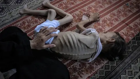 Starvation genocide in Gaza